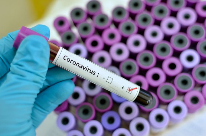 Here Is How The Coronavirus Is Affecting The Music Industry