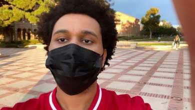 The Weeknd’s Plastic Surgery Look Shocks Fans