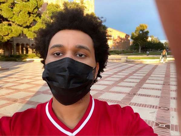 The Weeknd’s Plastic Surgery Look Shocks Fans