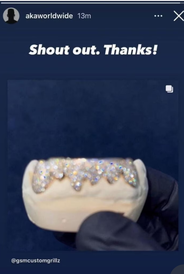 Check Out Aka'S 75K Bling Grill Set 2