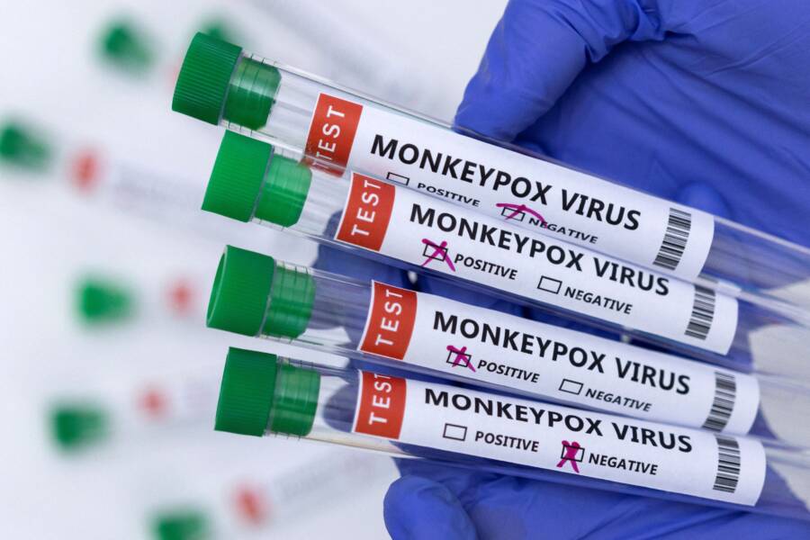 Monkeypox Vaccine Now Available For At-Risk New Yorkers 1