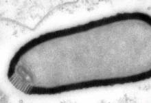 Long-Frozen “Zombie Virus” Spook Scientists – Warnings Issued
