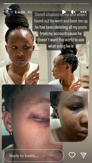 Sonia Mbele Reacts After Her Son, Donell Mbele, Is Called Out For Assaulting His Girlfriend 2