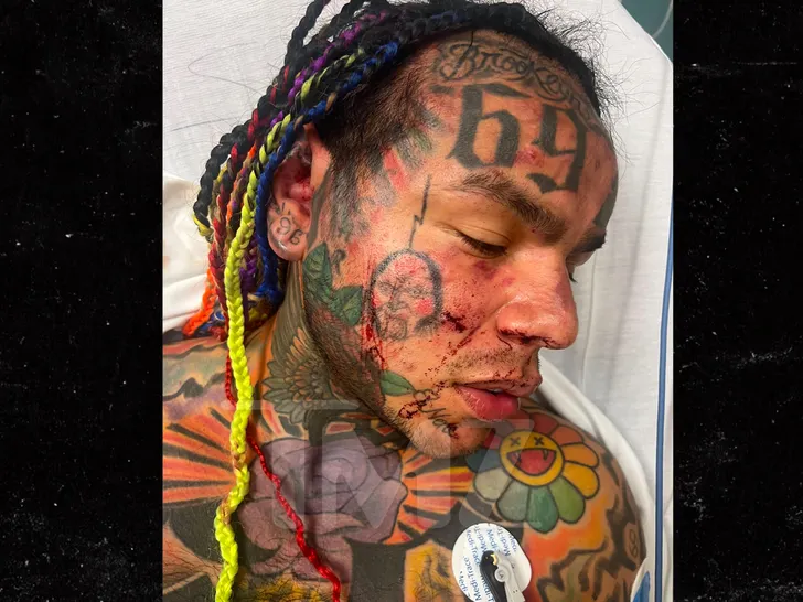 Police In Search Of Men Who Assaulted Tekashi 6Ix9Ine At The Gym 2